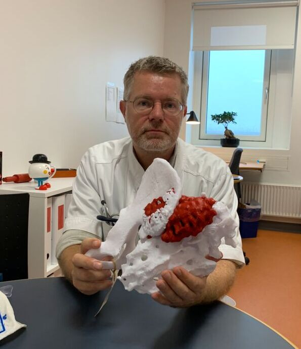 Overlæge Thomas Baad-Hansen med en 3D-printet kopi af sarkomet hos en yngre mand, som han har opereret for nyligt. - 3D-modellen er en enorm hjælp i planlægningen af en operation, siger han.